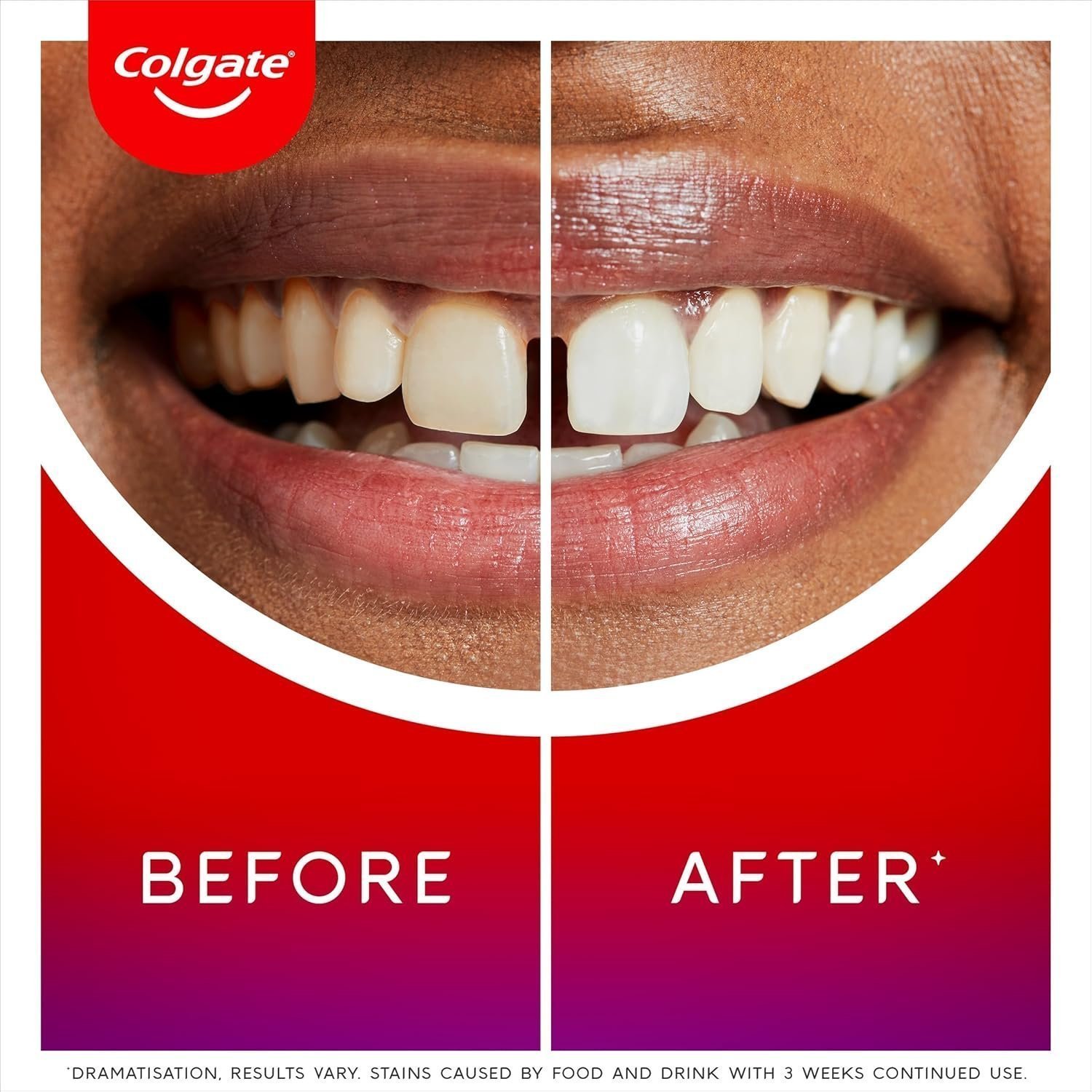 Colgate Max White Ultimate Radiance Toothpaste, Whiten Teeth and Reverse 15 Years of Stains, 75ml Tube - Image 6
