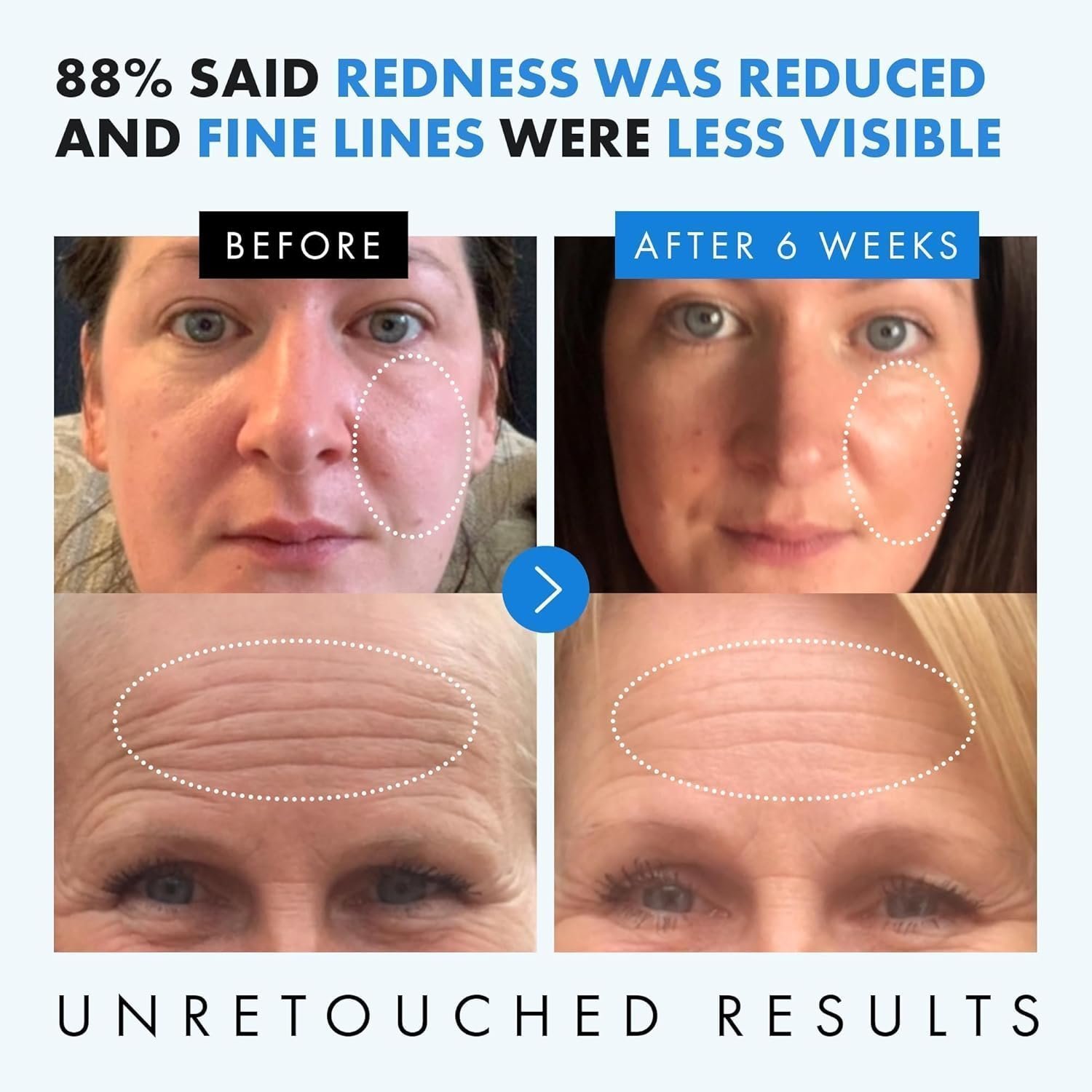 Hyaluronic Acid Serum for Face - 2.5% Hyaluronic Acid + 3% B5 with Vitamin C & E - Aloe Vera, Facial Serum for Anti Aging and Anti Wrinkle, - Image 3