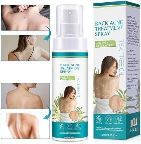 Back Acne Treatment, Back & Body Acne Treatment For Reduce Back Spots & Acne & Lightening Ance Marks - Image 4
