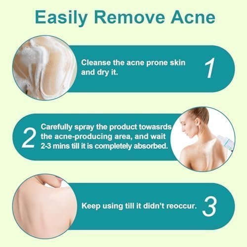 Back Acne Treatment, Back & Body Acne Treatment For Reduce Back Spots & Acne & Lightening Ance Marks - Image 3